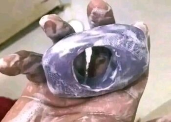 Illolin Yin Istimina’i (Masturbation) – Abubuwan Da Ya Kamata Ka Sani