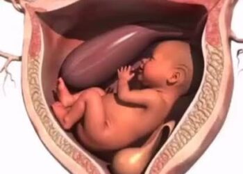 Yadda Ciki Yake Shiga: Abubuwan Da Zasu Iya Haifar Da Daukar Ciki