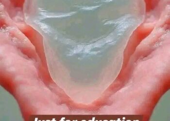 Yadda Budurci (Hymen) Yake Kafin Aure