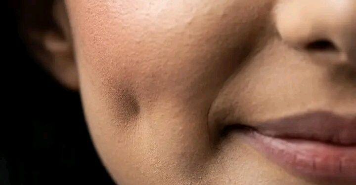 Shin Dimple Naƙasa Ne Ko Kyau? Ga Gaskiyar Da Ba Kowa Ya Sani Ba