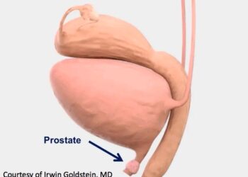Karshen Dadi Shine Ka Tabu Wa Mace Wajen Nan Lokacin Saduwa