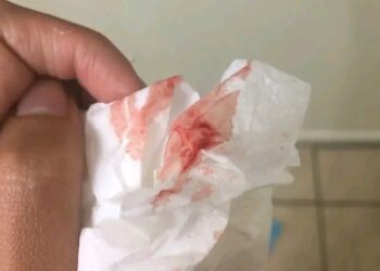 Kina Ganin Jini Bayan Saduwa? Ga Abin Da Zai Iya Nuna Game da Lafiyarki