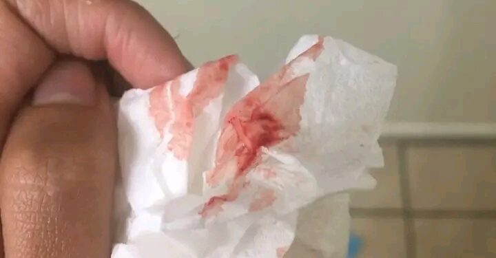 Kina Ganin Jini Bayan Saduwa? Ga Abin Da Zai Iya Nuna Game da Lafiyarki