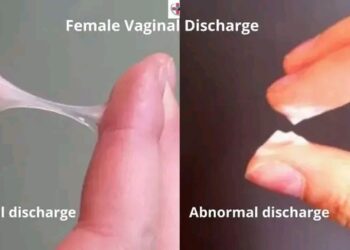 Abinda Yakamata Ma’aurata Su Sani Game Da Farin Ruwan Dake Fitowa Daga Farjin Mace Lokacin Saduwa