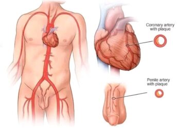 Yadda Lafiyar Zuciya Ke Shafar Ƙarfin Maza — Abin da Ya Kamata Kowa Ya Sani