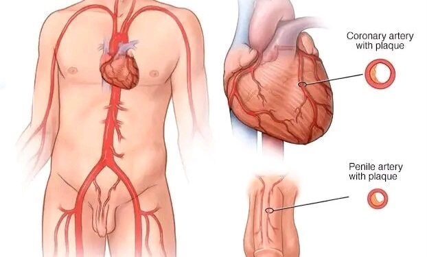 Yadda Lafiyar Zuciya Ke Shafar Ƙarfin Maza — Abin da Ya Kamata Kowa Ya Sani