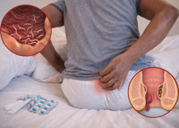 Kana Jin Ƙaiƙayi A Duburarka Musamman Lokacin Barci? Ga Abin Da Hakan Ke Nufi