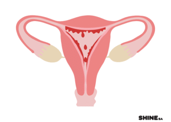 Wasu Daga Cikin Dalilan Da Za Su Hana Al’adar Mace Zuwa Alhali Ba Tada Juna Biyu