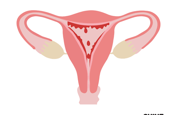 Wasu Daga Cikin Dalilan Da Za Su Hana Al’adar Mace Zuwa Alhali Ba Tada Juna Biyu