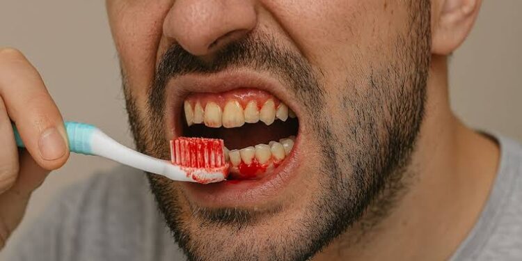 Dalilai 7 Da Ke Sa Kake Ganin Jini Lokacin Goge Haƙora — Kada Ka Yi Watsi!