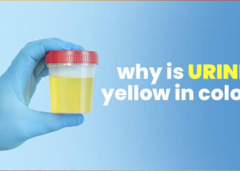 Idan Fitsarin Ka Ya Koma Yellow Yayin Azumi – Me Zai Faru?