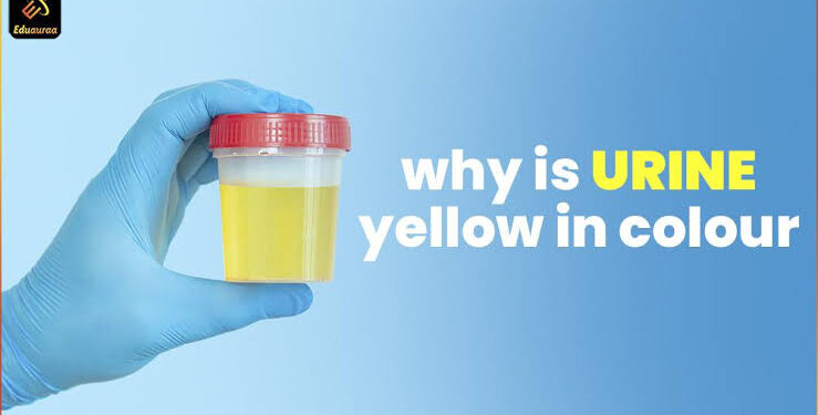 Idan Fitsarin Ka Ya Koma Yellow Yayin Azumi – Me Zai Faru?